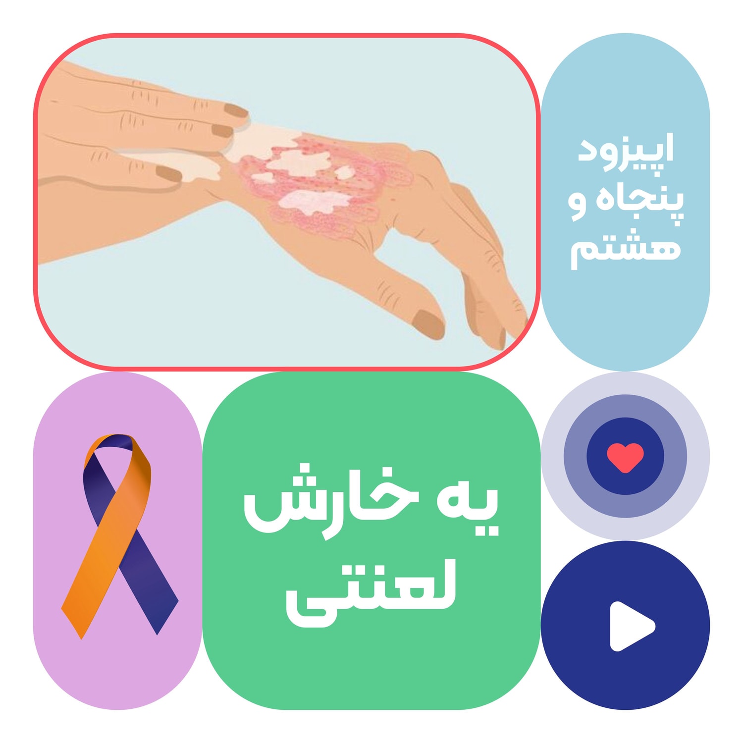 کاور اپیزود پنجاه و هشتم: یه خارش لعنتی