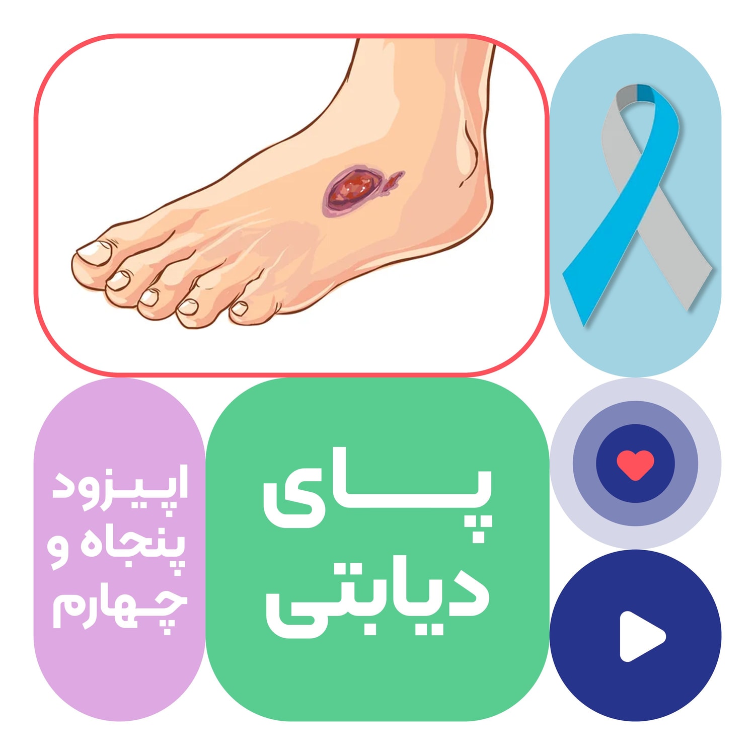 کاور اپیزود پنجاه و چهارم: پای دیابتی