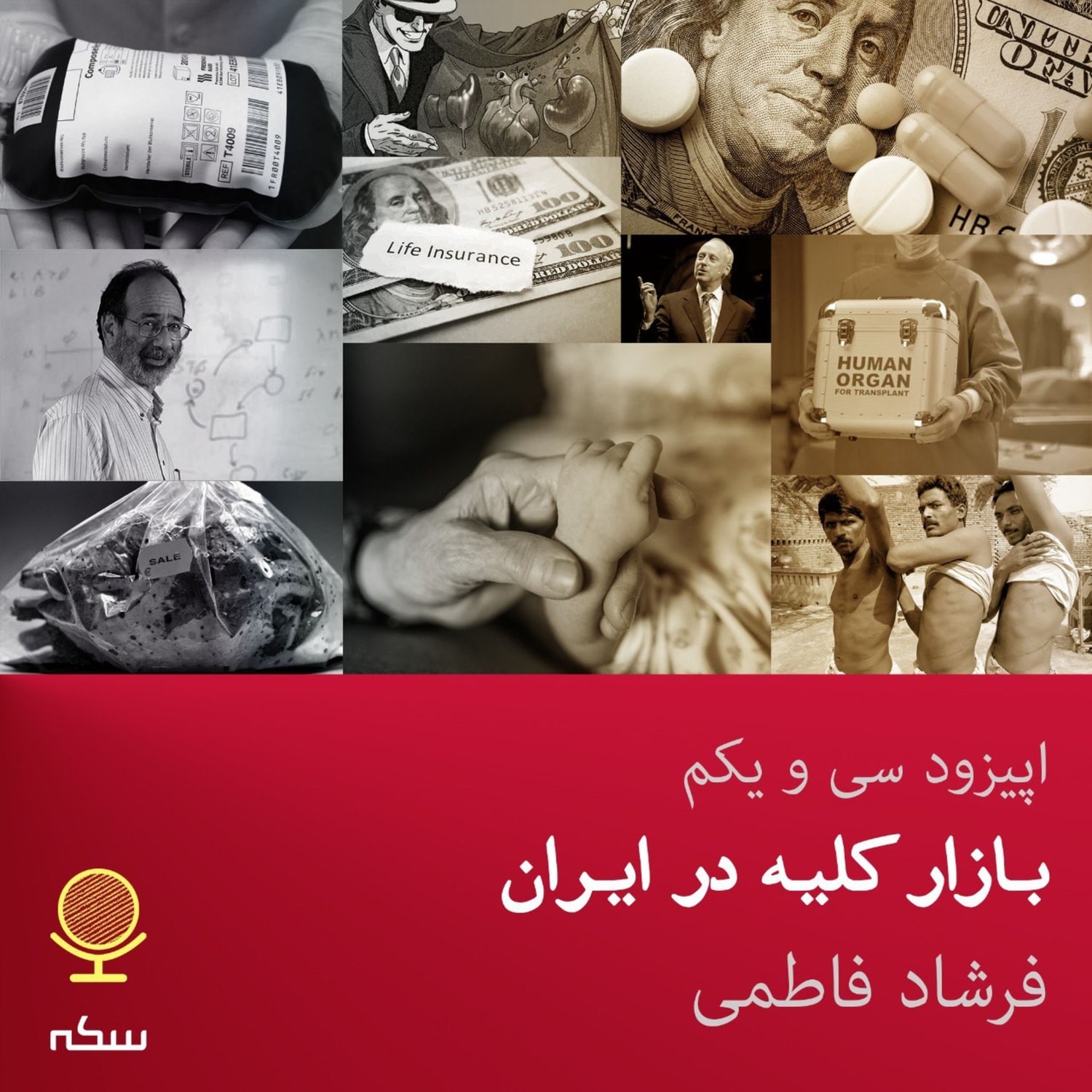 کاور ۳۱: بازار کلیه در ایران